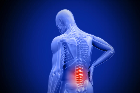spondylitis