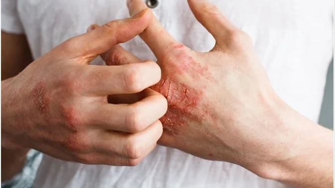 skin-disease-