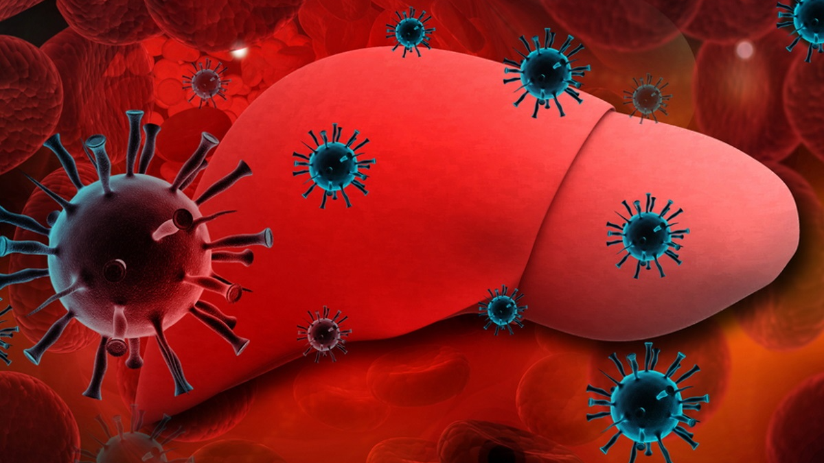 Hepatitis