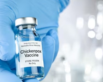 chickenpox